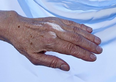 Bild: Arm
